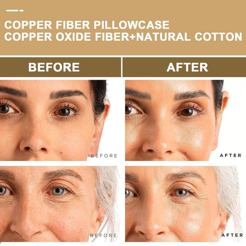 100% Copper Compression Copper Pillowcase for Beauty Hair gallery
