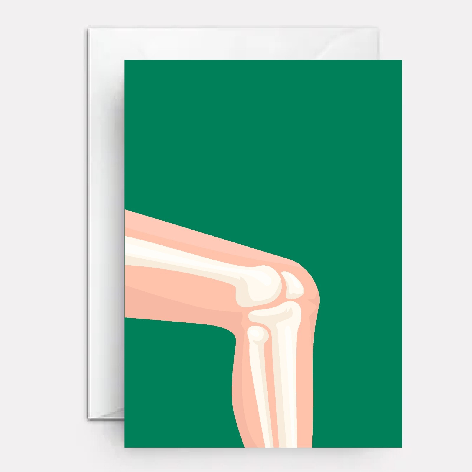 Knee surgery get well card | knee operation card | Knee-deep gallery